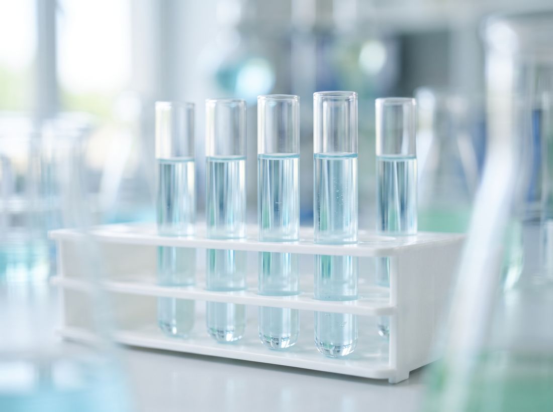 Laboratory sample tubes in a rack